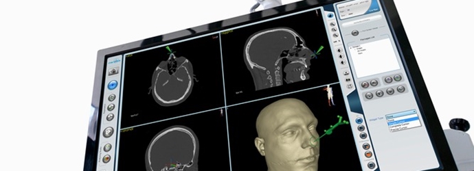 دستگاه OPTO (سامانه جراحی هوشمند پارسه)